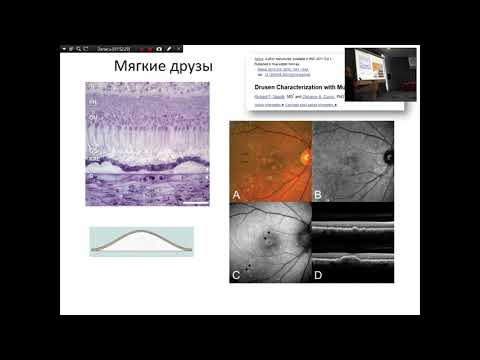 Видео: «Принципы диагностики и профилактики ранних стадий ВМД»