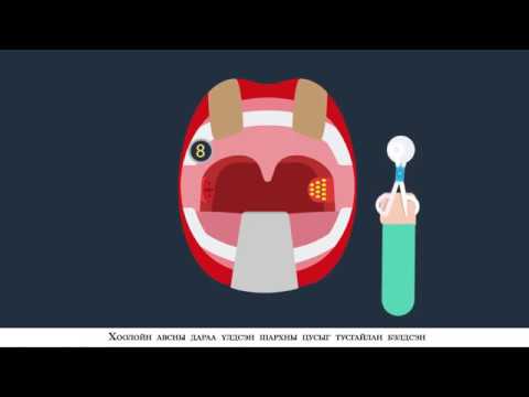Видео: ЧИХ ХАМАР ХООЛОЙН ЭМЧИЙН ЗӨВЛӨГӨӨ. 6.