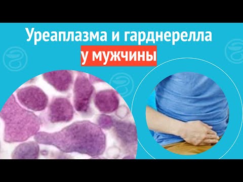 Видео: 😟 Уреаплазма и гарднерелла у мужчины. Клинический случай №1222