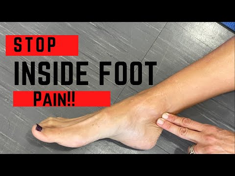 Видео: Лучший способ лечения тендинита задней большеберцовой мышцы