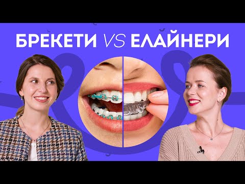 Видео: Брекети чи Елайнери, що краще? | Stoma Talk