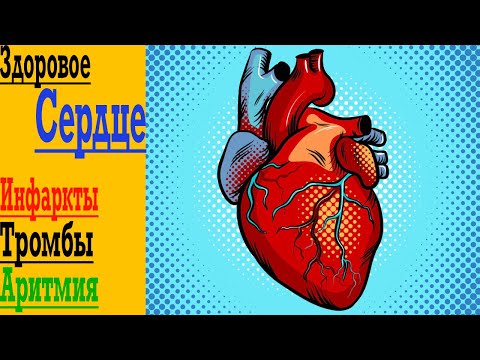Видео: Твоё Здоровое Сердце - Инфаркты, Тромбы и Аритмия !