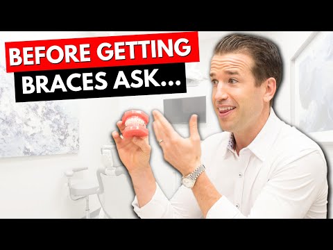 Видео: 10 ошеломляющих фактов о брекетах, о которых вы не знали