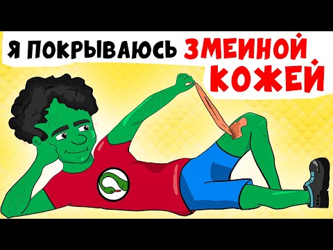 Видео: Я покрываюсь ЗМЕИНОЙ Кожей | Анимированные Истории