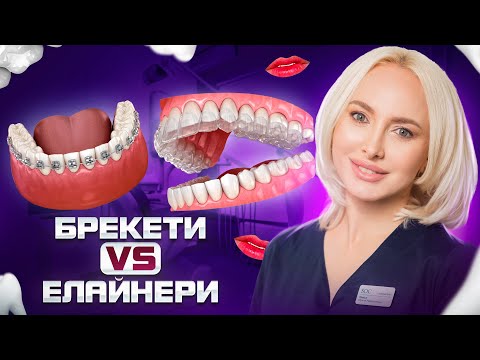 Видео: Елайнери дають лише 40% результату! Чому дорослі не мають ставити брекети? Скільки коштує лікування?