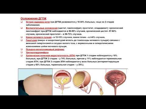 Видео: УЗИ. Доктор Иогансен. Выпуск 117.  Доброкачественная гиперплазия предстательной железы. Часть 3.