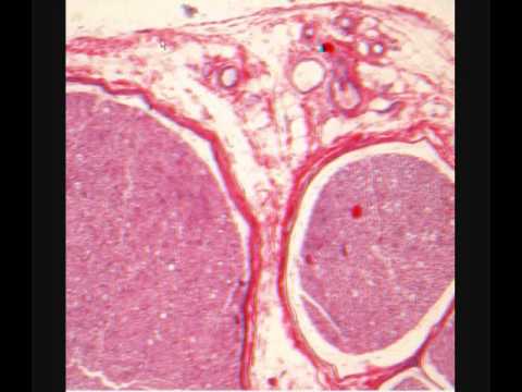 Видео: ПЕРИФЕРИЧЕСКИЙ НЕРВ. Nerve. Гистологическое строение