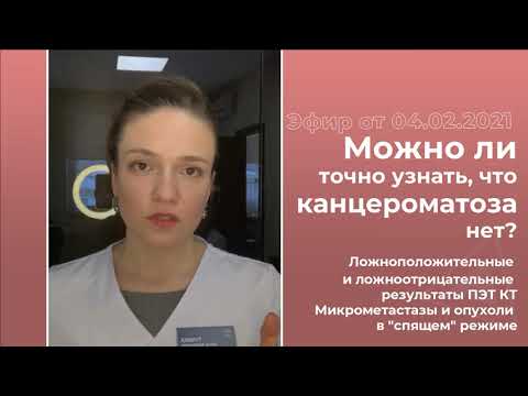 Видео: Канцероматоз: как исключить?
