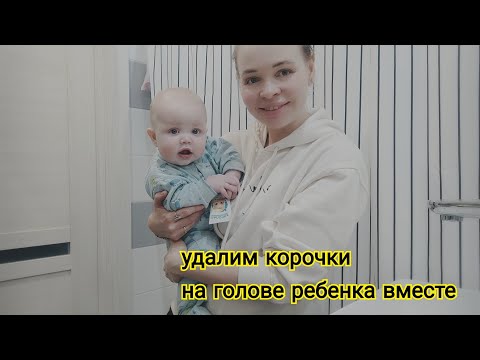 Видео: Лучший способ удаления корочек на голове ребенка 👍 Проверила сама 🤱