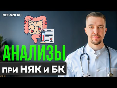 Видео: В каком СОСТОЯНИИ нужно сдавать анализы при НЯК #няк #взк #язвенныйколит #анализы 