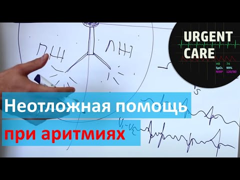 Видео: Неотложная помощь при аритмиях