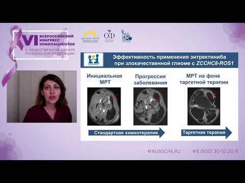Видео: Папуша Людмила Ивановна - Опухоли центральной нервной системы у детей - от фатальности к излечению