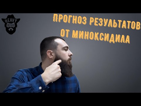 Видео: Как понять какие будут результаты от миноксидила?