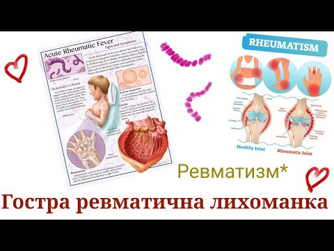 Видео: Гостра ревматична лихоманка. Ревматизм (лекція)