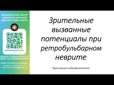 Видео: Тема: Зрительные вызванные потенциалы при ретробульбарном неврите.