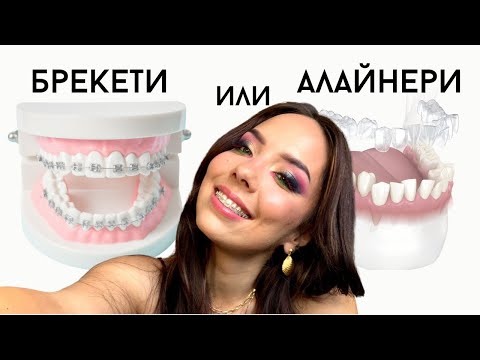 Видео: БРЕКЕТИ или АЛАЙНЕРИ ★ моят опит