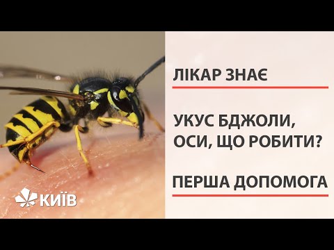 Видео: Що робити якщо вкусила бджола, або оса: перша допомога #ЛікарЗнає