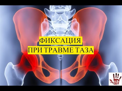 Видео: ФИКСАЦИЯ ТАЗА