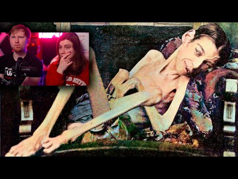 Видео: "ЖИВОЙ СКЕЛЕТ". Трагическая История САМОГО ХУДОГО Человека Весом 19-кг | РЕАКЦИЯ