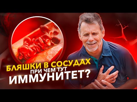 Видео: Как очистить сосуды от бляшек? Рассказываем о методе Лимфатек.