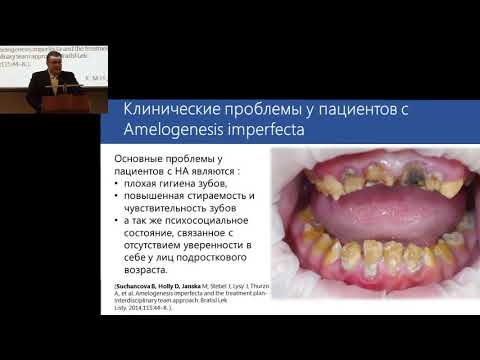 Видео: 19.02.2017 - Стоматологическая реабилитация детей с пороками развития зубов