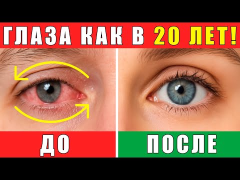 Видео: ГИМНАСТИКА ДЛЯ ГЛАЗ | 10 упражнений СПАСАЮТ ЗРЕНИЕ
