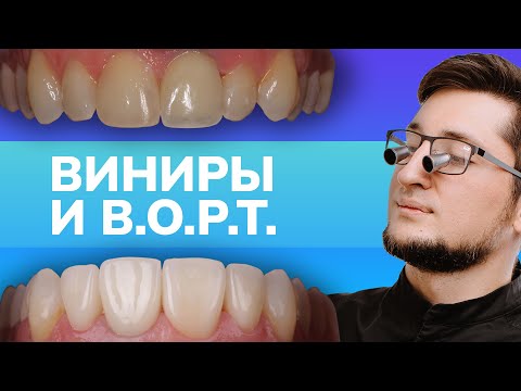 Видео: Виниры и B.O.P.T - дентал кейсы