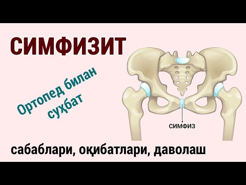 Видео: Симфизит: сабаблари, оқибатлари ва даволаш.