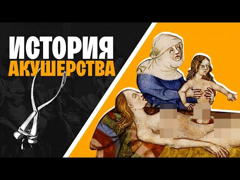 Видео: Мировая история акушерства