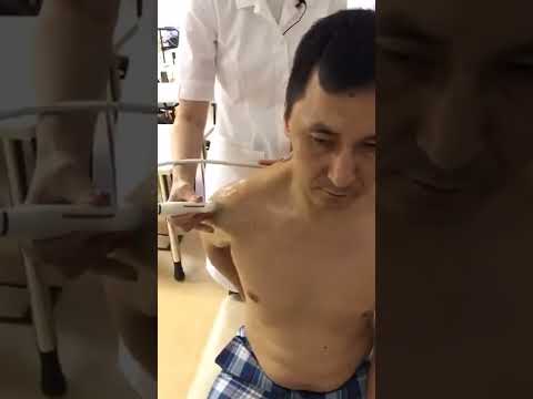 Видео: #УЗИ плечевого сустава