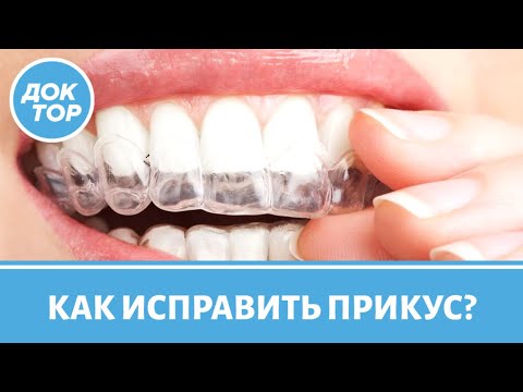 Видео: Как исправить НЕПРАВИЛЬНЫЙ ПРИКУС? Вопросы врачу