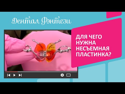 Видео: Для чего нужна несъёмная пластинка для зубов❓🦷 Ортодонт Климова Инна