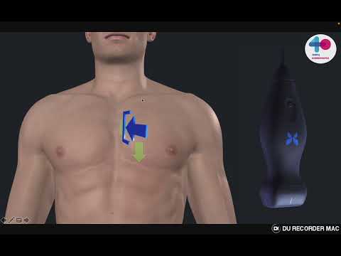 Видео: HOW TO  Мониторинг волемического статуса верхняя полая вена