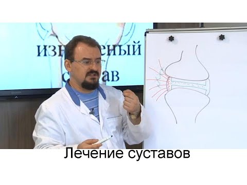 Видео: Болезни суставов