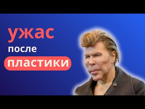 Видео: Пугающая пластика мужчин — что стало со звёздами?