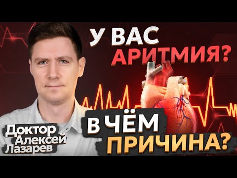 Видео: У ВАС АРИТМИЯ? В ЧЕМ ПРИЧИНА? #аритмия #докторалексейлазарев #фибрилляция предсердий