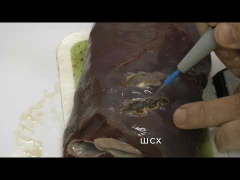 Видео: Электрохирургия. Коагулятор ValleyLab FT10-коагуляция