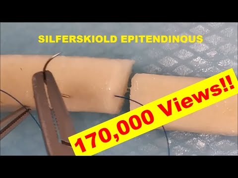 Видео: Методы восстановления сухожилий сгибателей