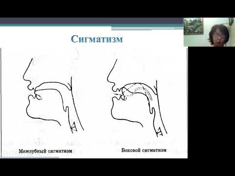 Видео: МЛР Общее о дисл Л3 2