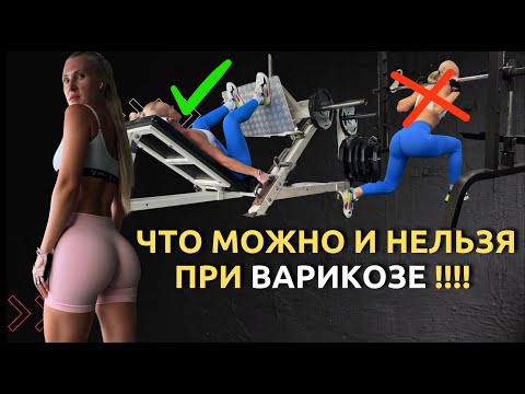 Видео: Как накачать ягодицы при варикозе? Безопасные упражнения и ошибки, которых стоит избегать