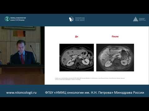Видео: Новые возможности лечения пациентов с неоперабельной липосаркомой