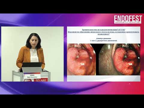 Видео: Секция Амбулаторная эндоскопия ЭндоФест 2023
