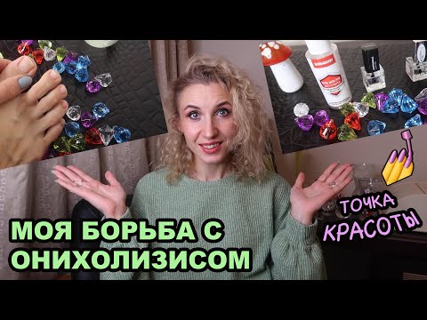 Видео: Онихолизис (Отслоение ногтей)💅Причины появления🎱Удалось ли мне справиться с  онихолизисом?
