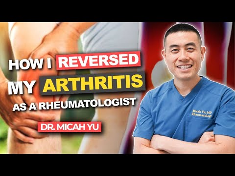 Видео: Как я, будучи ревматологом, ЕСТЕСТВЕННЫМ ПУТЕМ ВЫЛЕЧИЛ АРТРИТ | Доктор Мика Ю