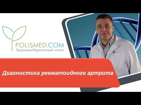 Видео: Диагностика ревматоидного артрита (РА): анализы крови и мочи, ревматоидный фактор, тест на АЦЦП