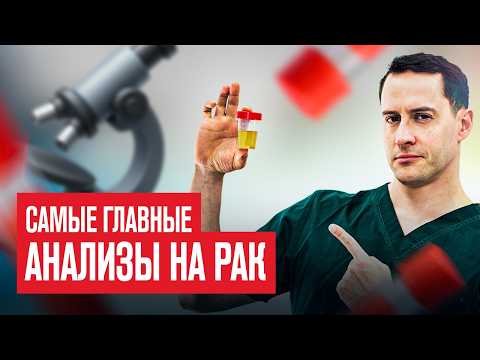 Видео: Эти анализы покажут рак до симптомов! Чек лист от онколога.