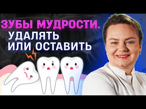 Видео: Зубы мудрости. Нужно ли удалять зубы мудрости?