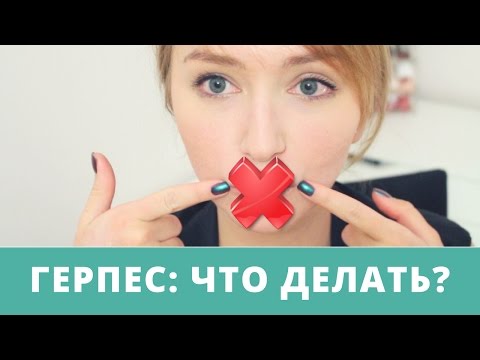 Видео: ГЕРПЕС: убрать за ОДИН день + техника безопасности