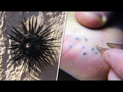 Видео: 8 Существ с Самыми Болезненными Укусами в Природе