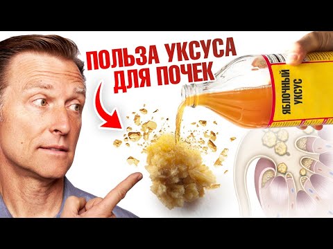 Видео: Пейте яблочный уксус для профилактики камней в почках 🔥